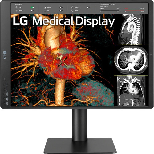 LG 21.3" 3mp IPS Diagnostic Monitor - LG Electronics, U.S.A.