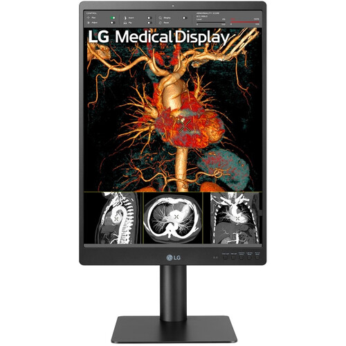LG 21.3" 3mp IPS Diagnostic Monitor - LG Electronics, U.S.A.
