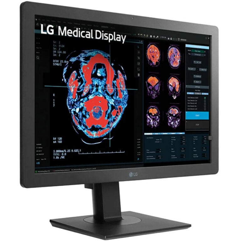 lg surgical monitor
